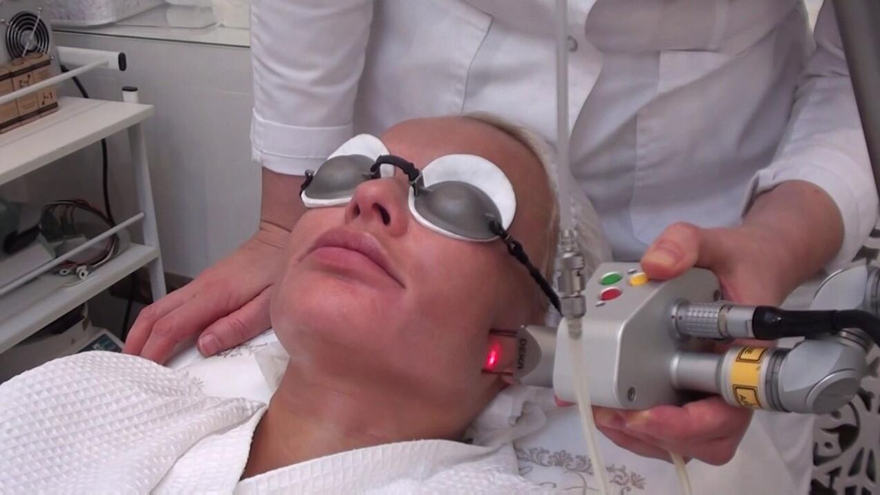 Laser treatment of problematic areas of facial skin